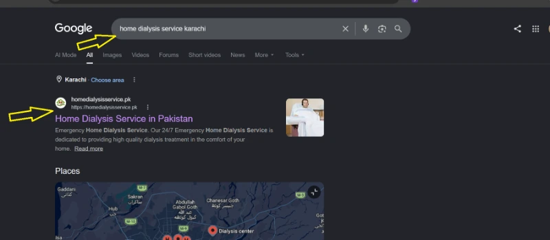 Google results showing the home dialysis service ranked first in Karachi